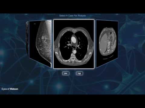 IBM researchers bring AI to radiology