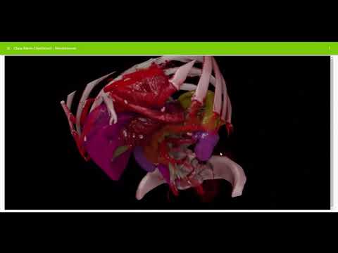 NVIDIA Holoscan: AI Computing for Medical Devices